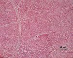10 – Aspetto della fase “Hymenoclonium”